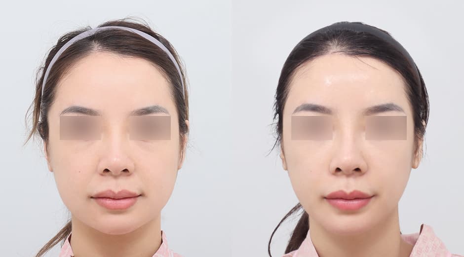 AB Plastic Surgery