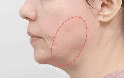 ก่อนผ่าตัด