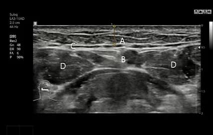 ภาพถ่าย CT ก่อนผ่าตัด