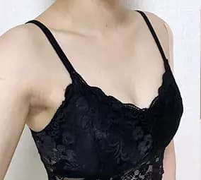 ก่อนผ่าตัด