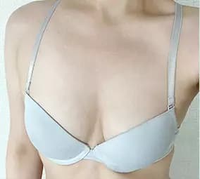 ก่อนผ่าตัด