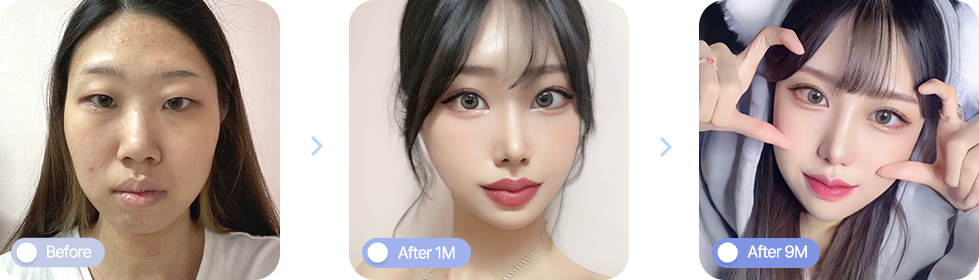 AB plastic surgery