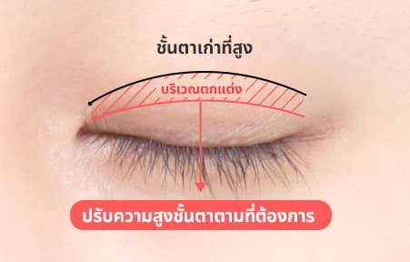 AB Plastic Surgery