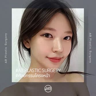 ศัลยกรรมโครงหน้า