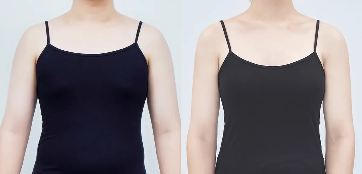 Before and after surgery