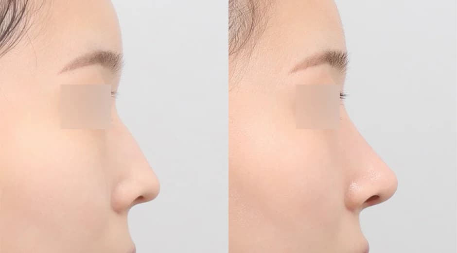 AB Plastic Surgery