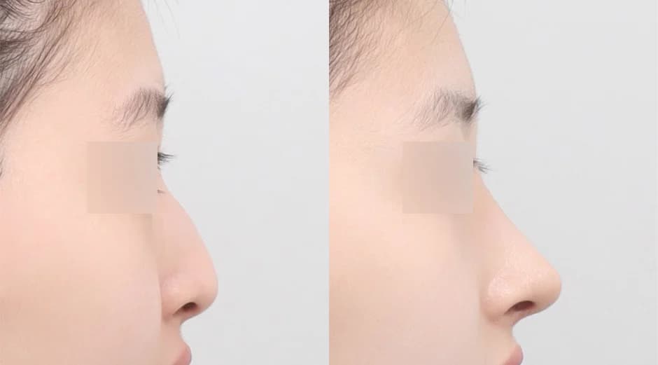 AB Plastic Surgery