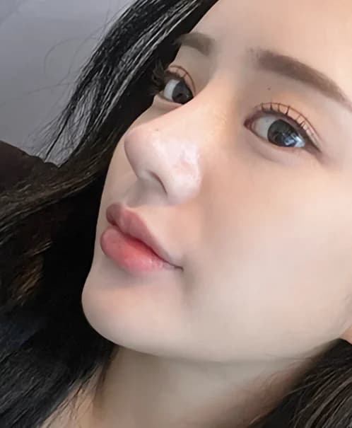 Glamorous nose tip