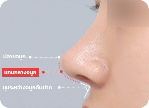 NaturGlow columella line diagram
