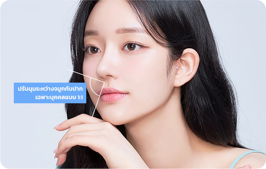 1:1 customized nasolabial angle