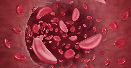 การฉีดสเต็มเซลล์จากเลือด