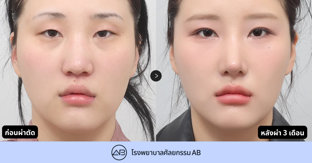 AB Plastic Surgery