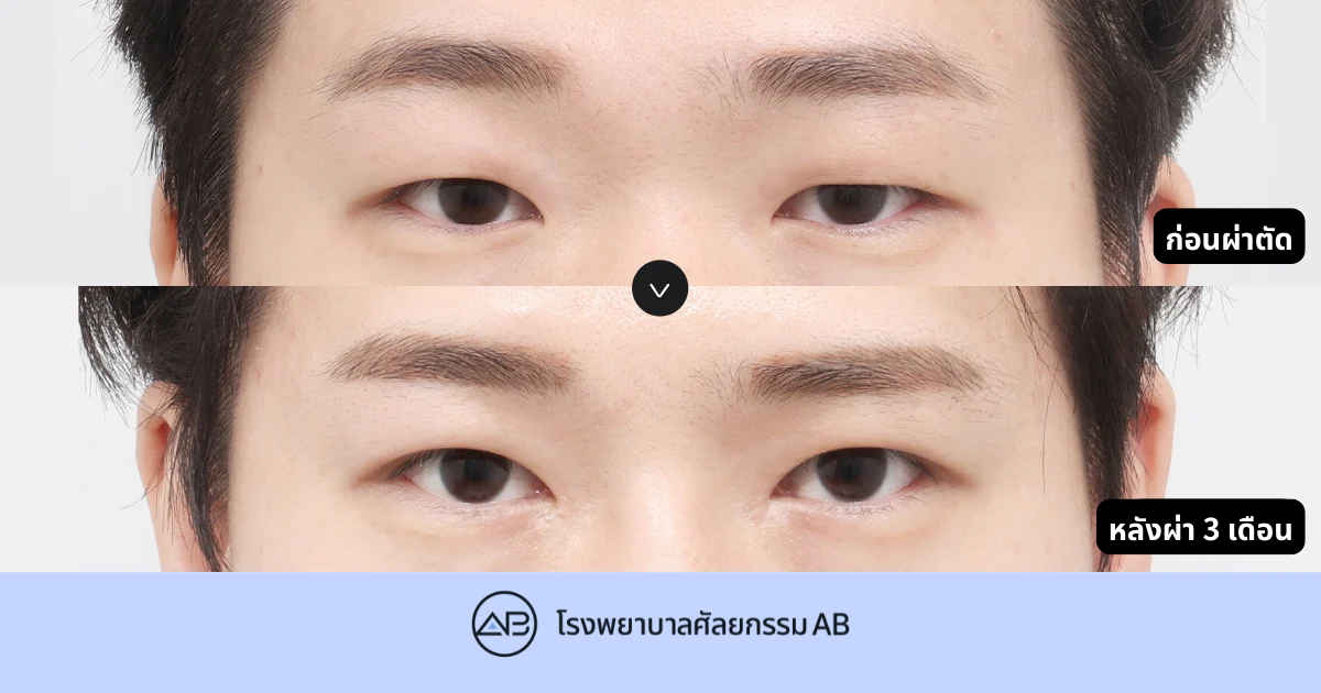 AB Plastic Surgery
