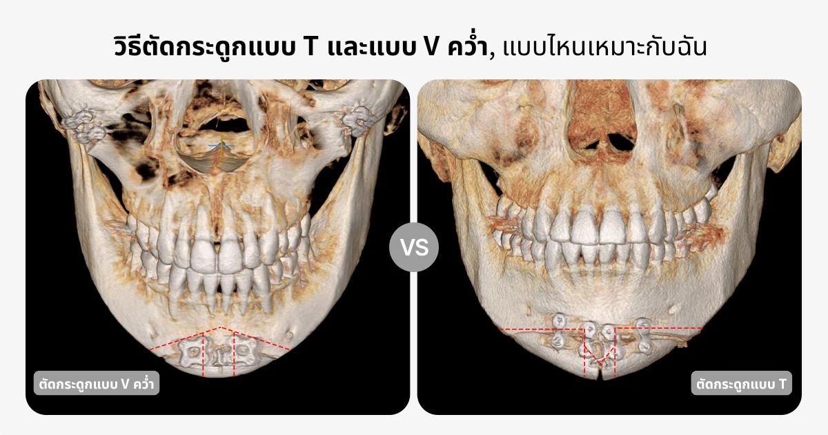 AB Plastic Surgery