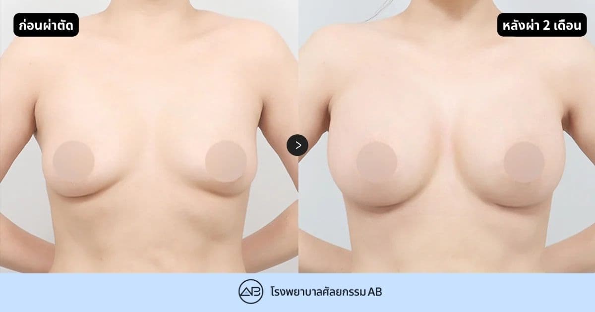 AB Plastic Surgery
