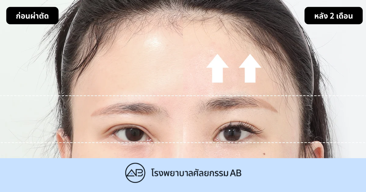 AB Plastic Surgery