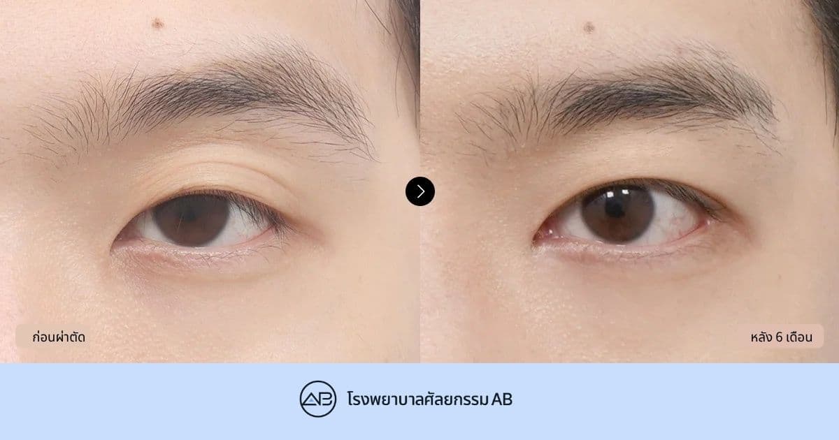 AB Plastic Surgery