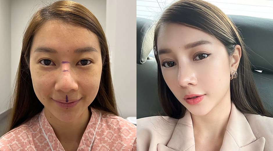 ที่ติดอันดับสูงสุดที่คนเกาหลีศัลยกรรม!