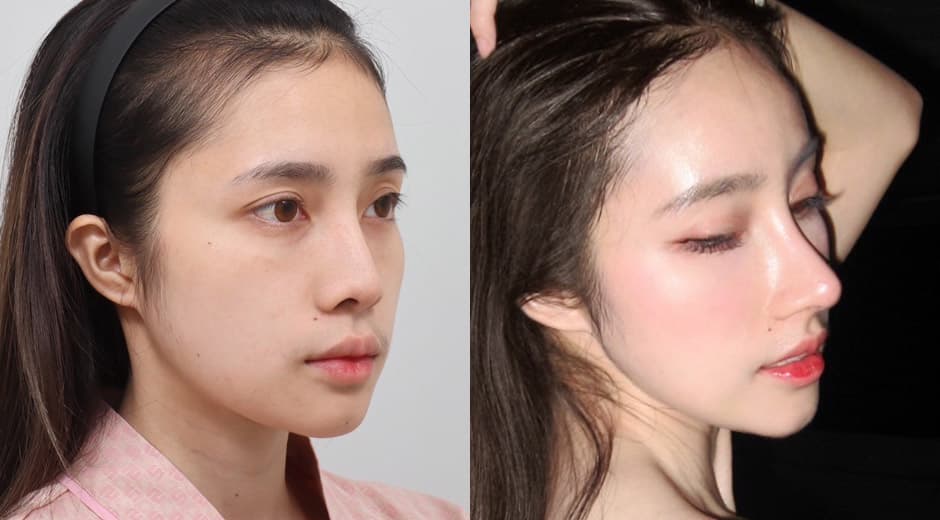 ขอโทษทีสวยมากกว่าเดิมนะจ๊ะ