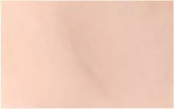 หลังผ่าตัด 6 เดือน