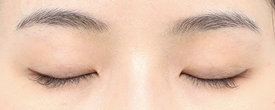 AB plastic surgery
