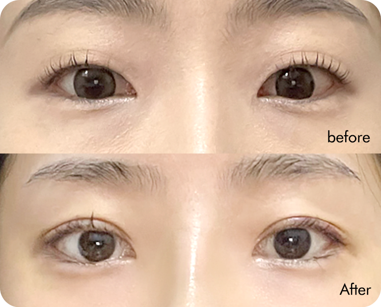 AB plastic surgery