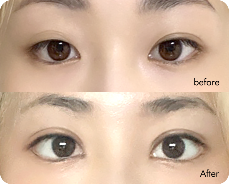 AB plastic surgery