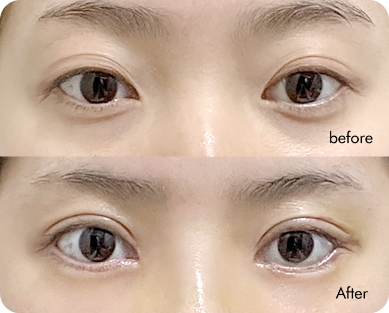 AB plastic surgery