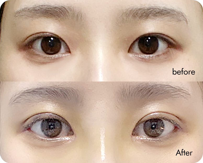 AB plastic surgery