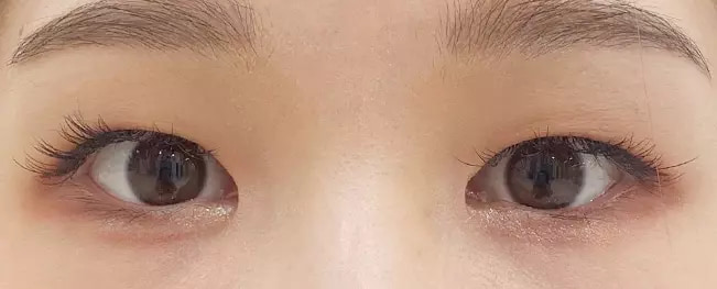 Long lasting before after case 7