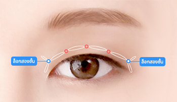 NaturGlow transparent adhesion surgery step 02