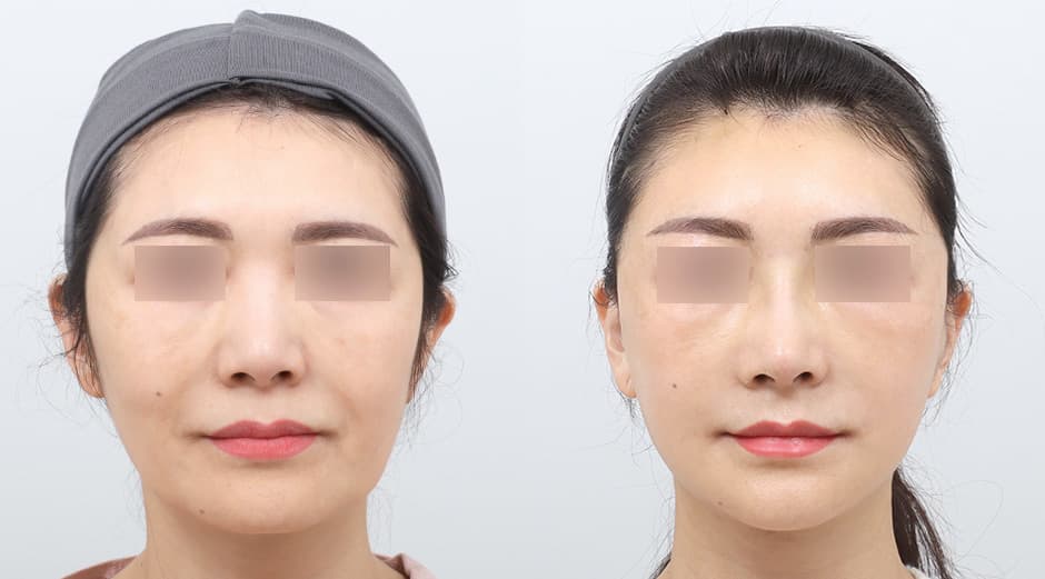 AB Plastic Surgery