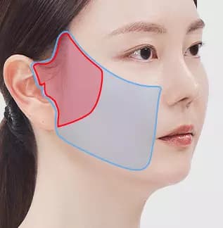 ยกกระชับหน้าส่วนกลางแบบ Semi-Full Facelift