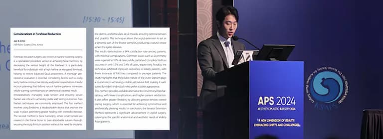 การค้นคว้าวิจัยเรื่องการ Lifting