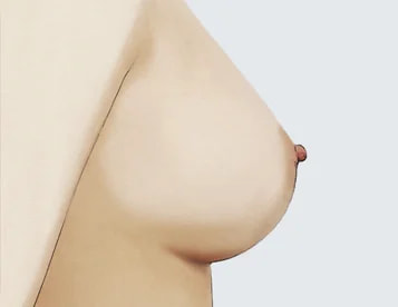 หน้าอกปกติ