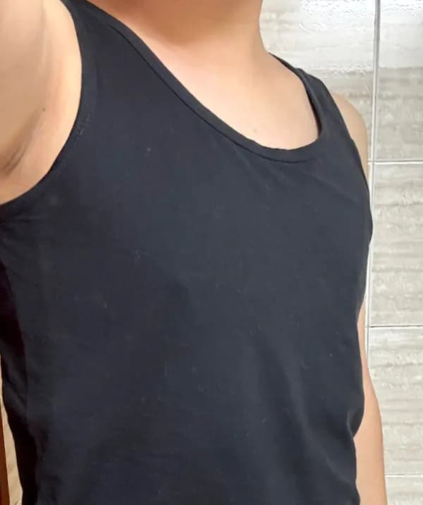 ก่อนผ่าตัด
