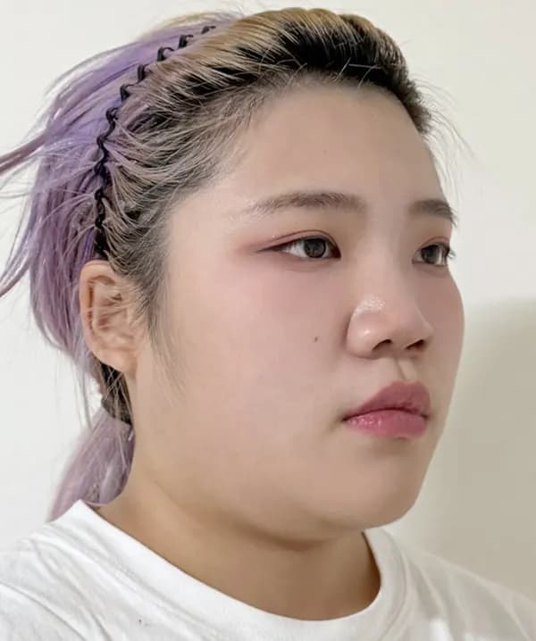 ก่อนผ่าตัด