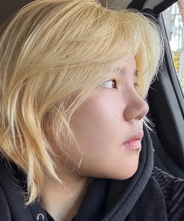 หลังผ่าตัด 21 วัน