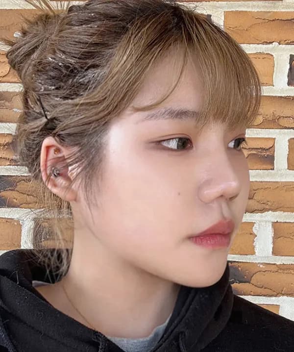 หลังผ่าตัด 90 วัน