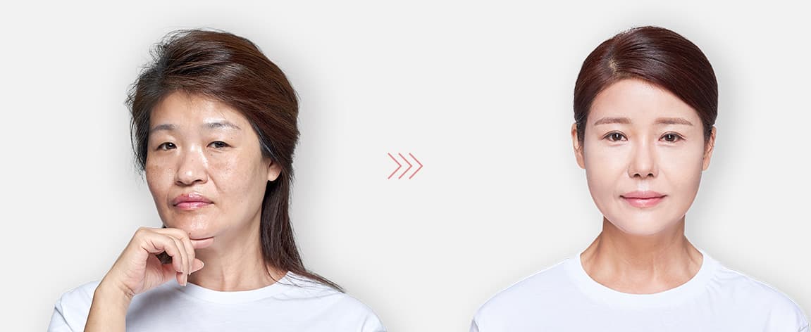 Mothers Before & After image