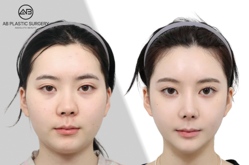 AB Plastic Surgery