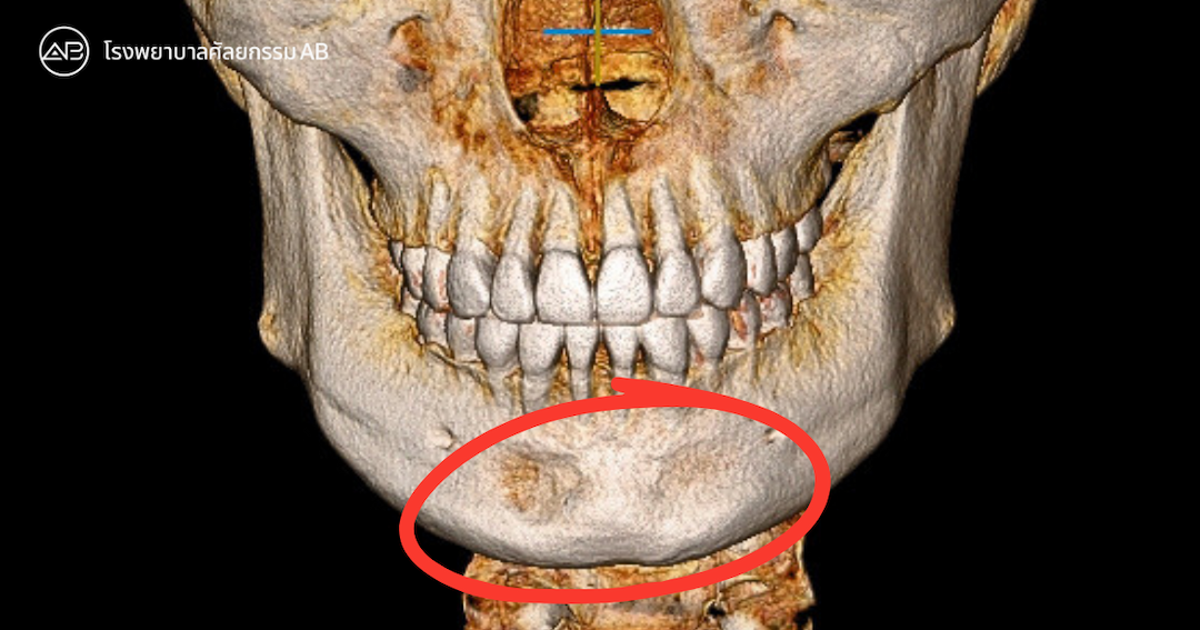 AB Plastic Surgery