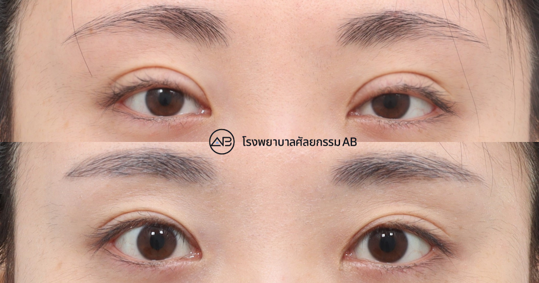 AB Plastic Surgery