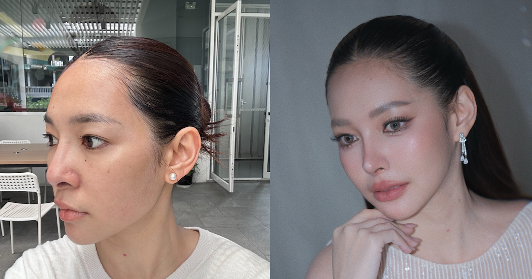 รีวิวศัลยกรรมเกาหลี! แก้จมูกตามเรฟ AI ผลลัพธ์จะเหมือนแค่ไหน? พร้อมปรับขนาดหน้าอก ที่โรงพยาบาลศัลยกรรม AB