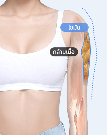 Fat and muscle before precise diagnosis