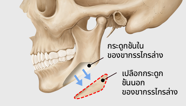 surgery_illust