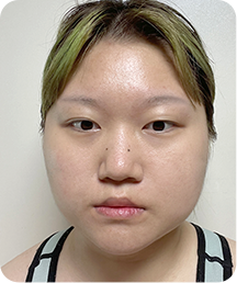 맥미걸 악플콜렉터 Before후 사진