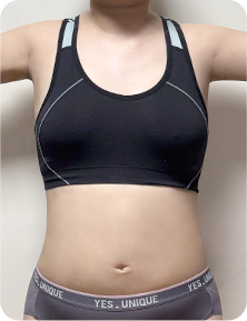 맥미걸 악플콜렉터 Before후 사진