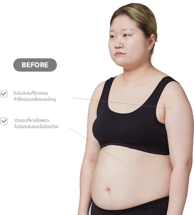 맥미걸 악플콜렉터 바디 수술 전 문제점과 개선점