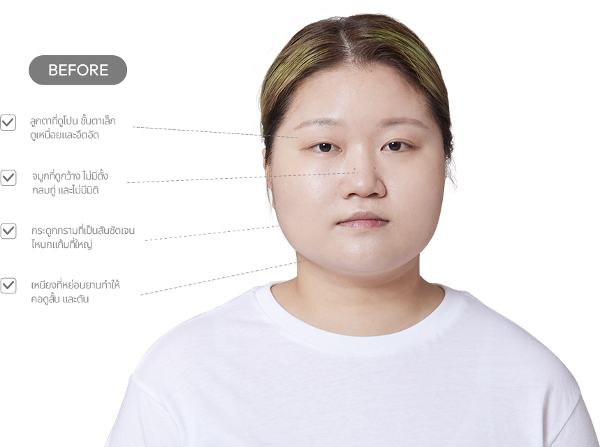 맥미걸 악플콜렉터 얼굴 수술 전 문제점과 개선점